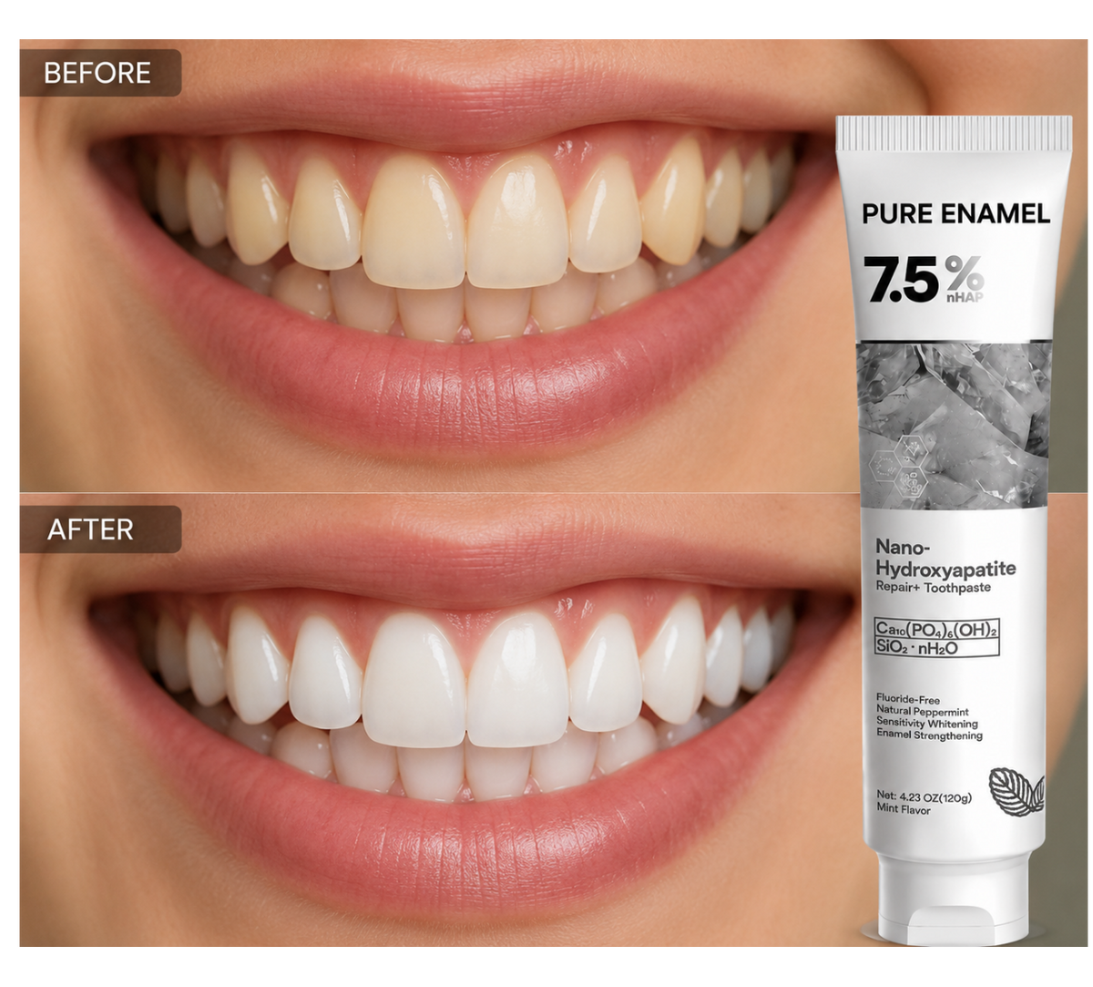 Hydroxyapatite Remineralizing Toothpaste